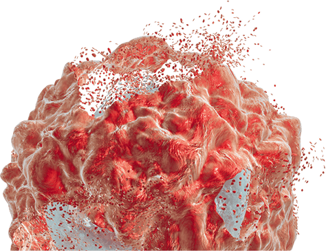 Image of tumor cell dying