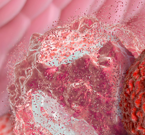 Illustration of a tumor microenvironment.