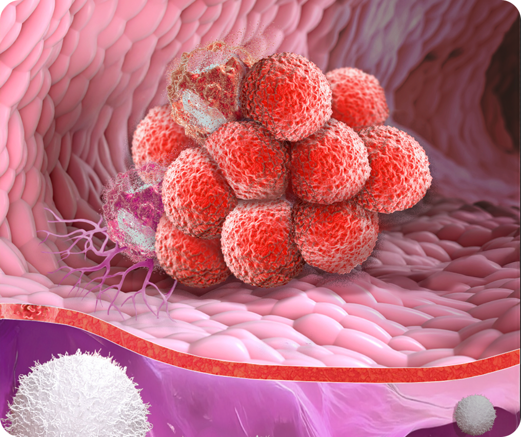 Illustration of a tumor microenvironment.